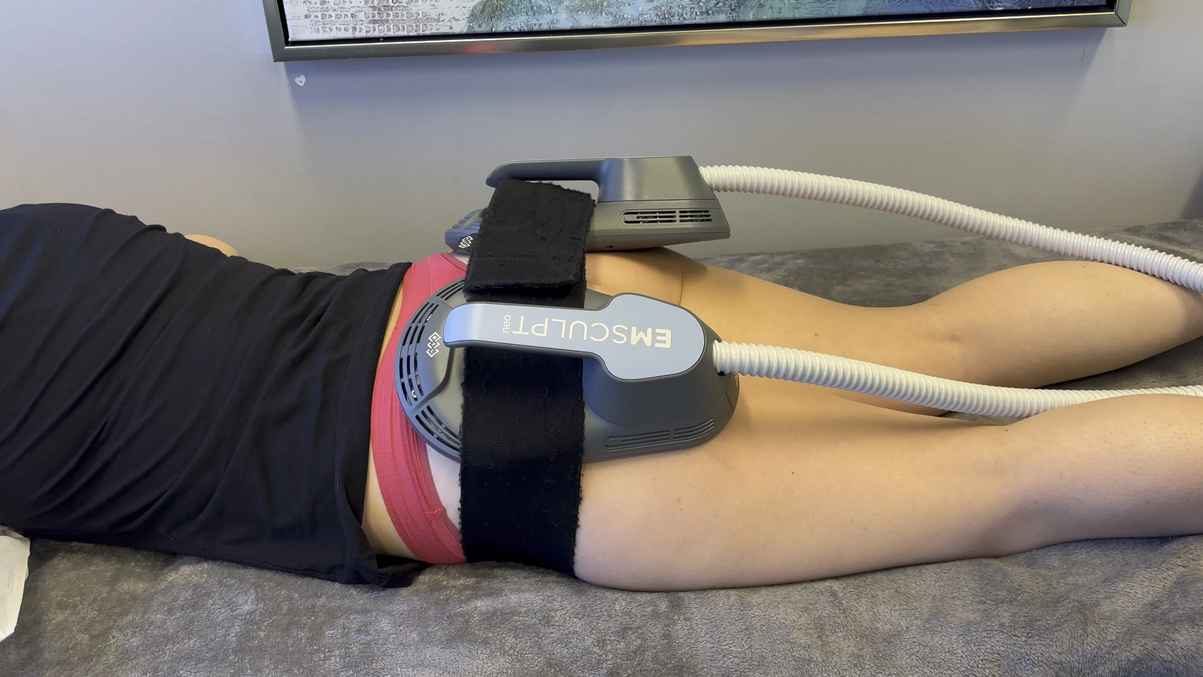 Emsculpt NEO Treatment | Non-Invasive Body Contouring & Toning